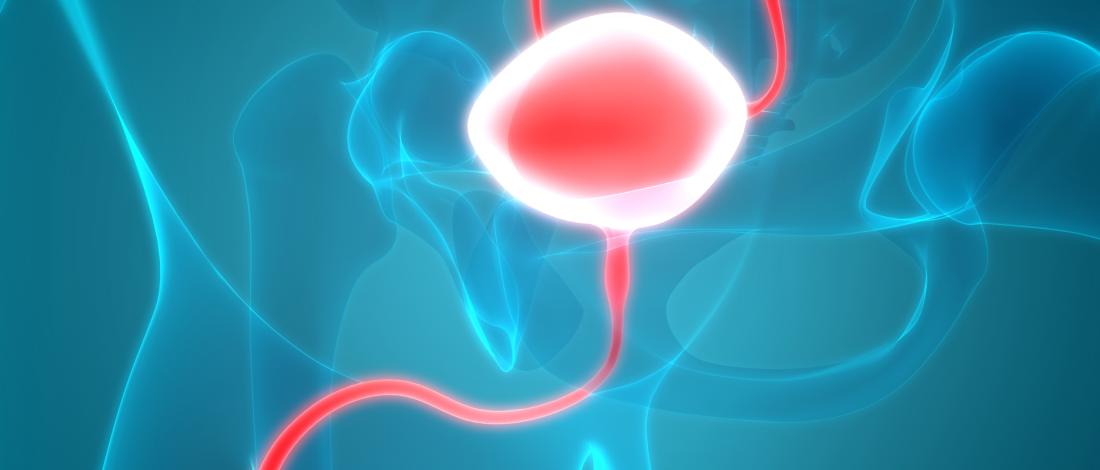 Urothelial Cancer
